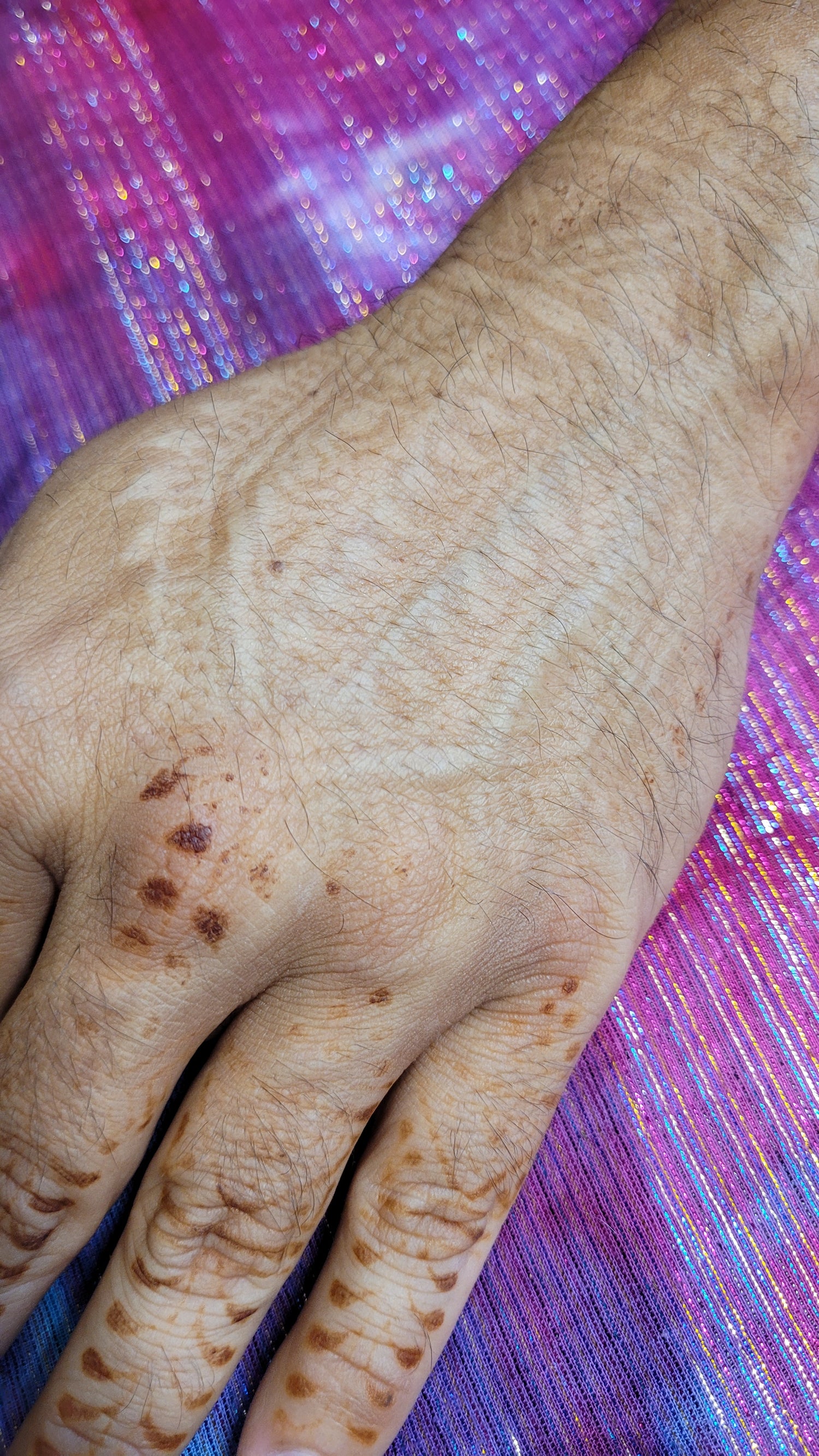 The top of a hand with a reverse henna stain. the finger still have lingering henna stain.